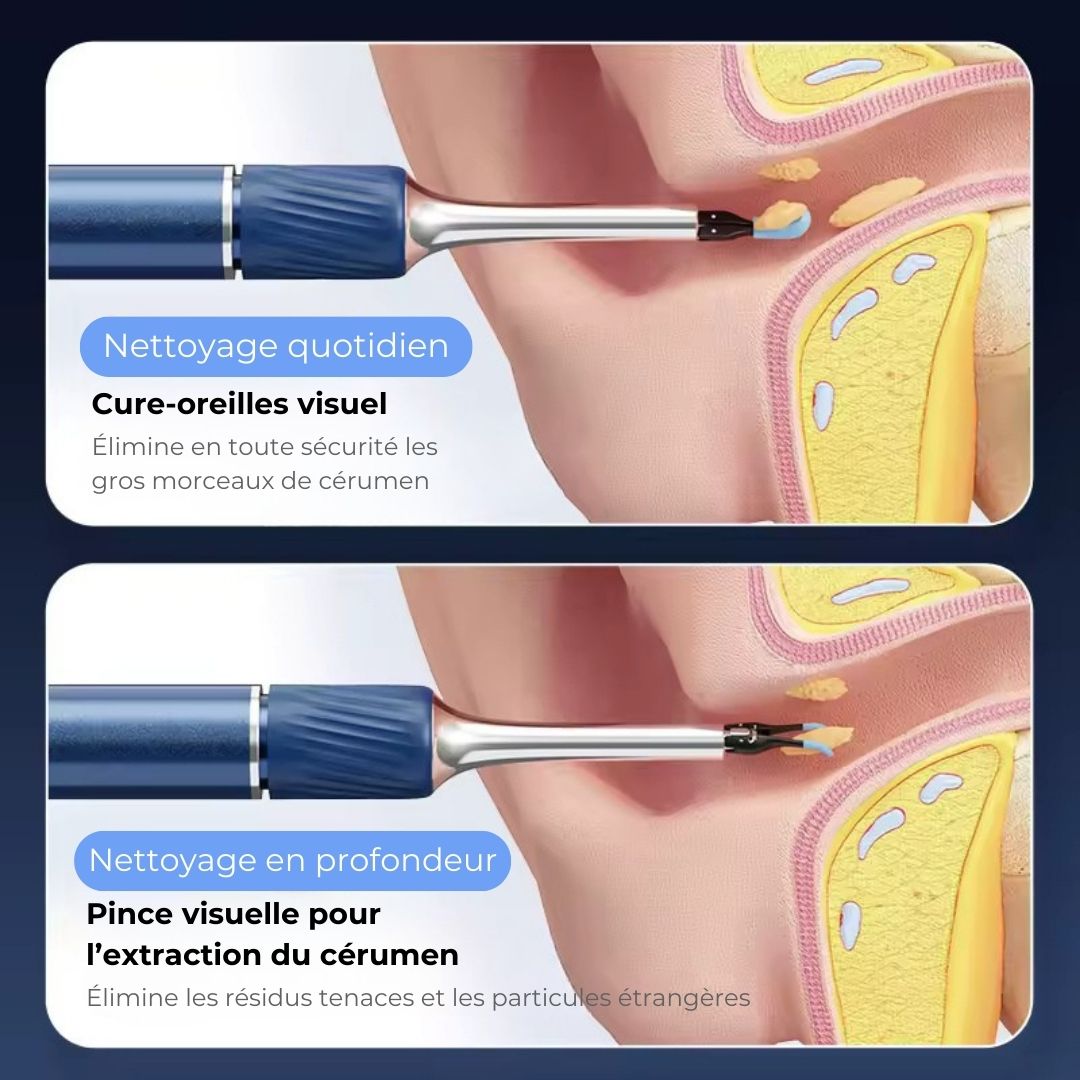 Nettoyeur d’oreilles intelligent sans fil avec caméra (Android/iOS)